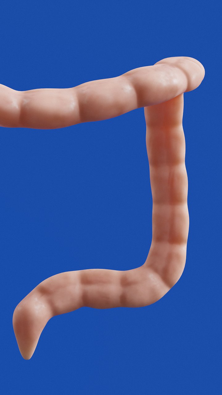 Colorectal surgery